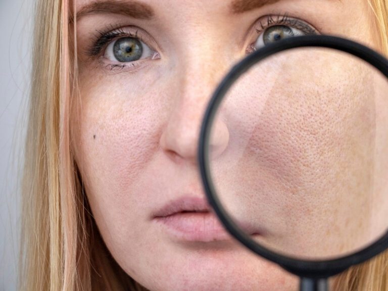 Featured image for minimizing pores naturally