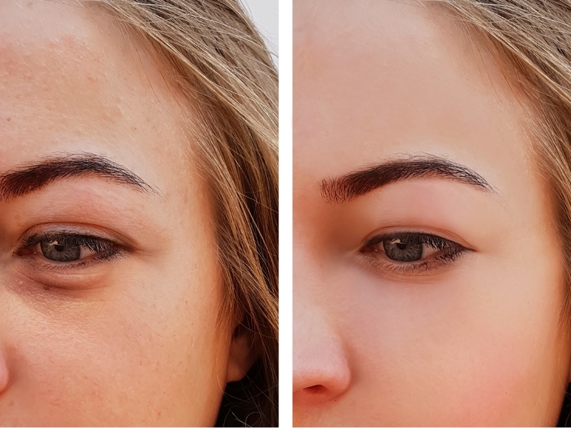 woman with refreshed eyes after using peptide eye cream