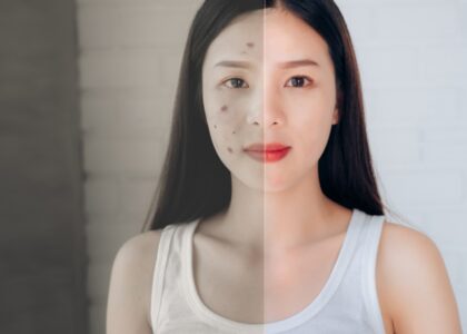 Woman with glowing skin after a double cleansing routine using oil-based and water-based cleansers.