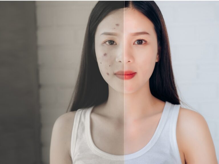 Woman with glowing skin after a double cleansing routine using oil-based and water-based cleansers.